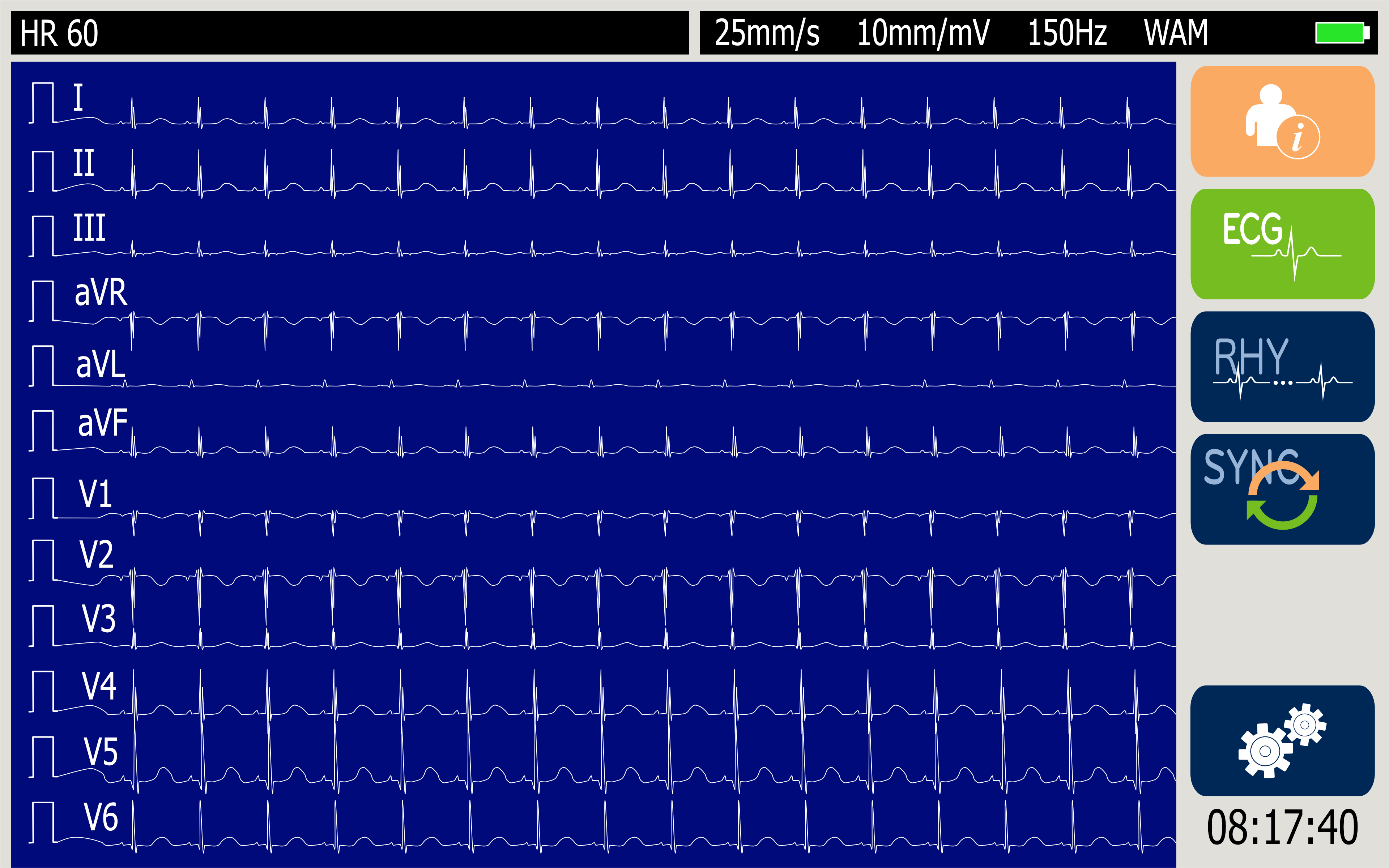 Eli280_Main_Image