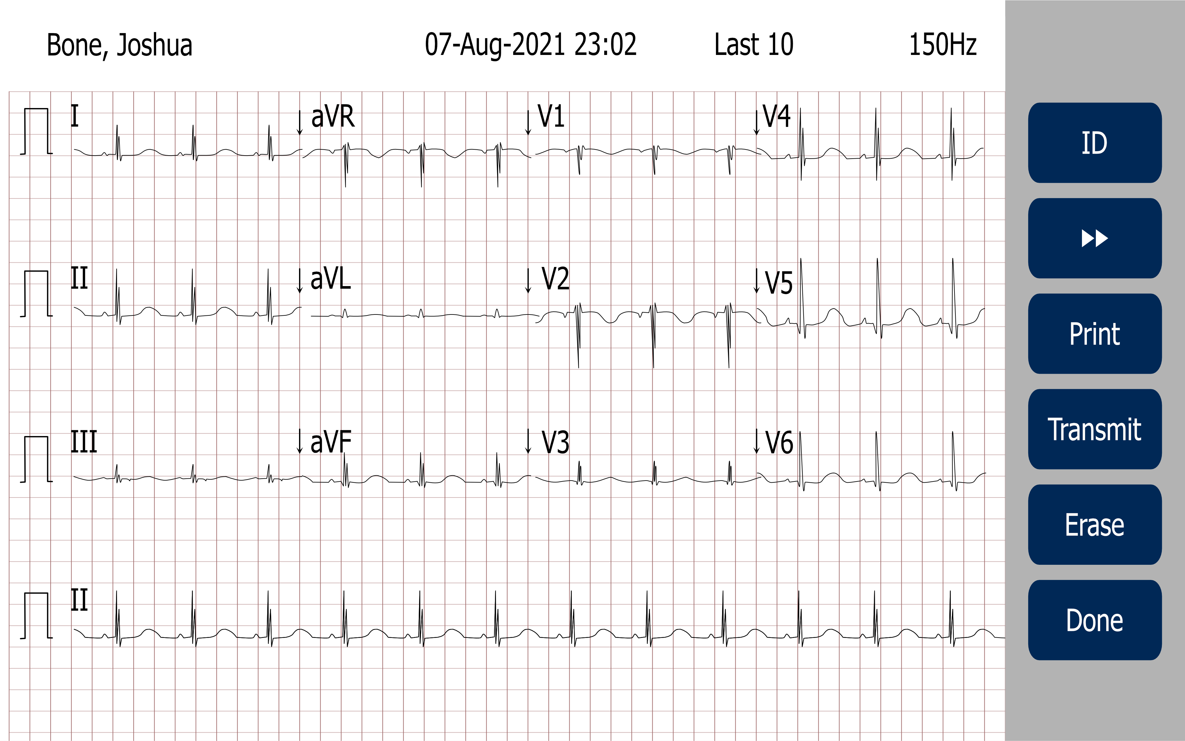 ELI 280 ECG Resting Electrocardiograph | Hillrom